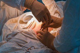 Bariatric and Diabetic Surgery